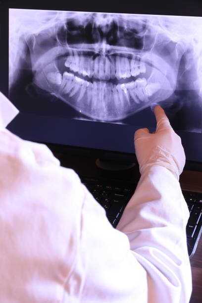 Best Emergency Dentist for Lost Fillings or Crowns in Sugarcreek, PA