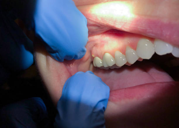 Best Emergency Dental Extractions in Sugarcreek, PA